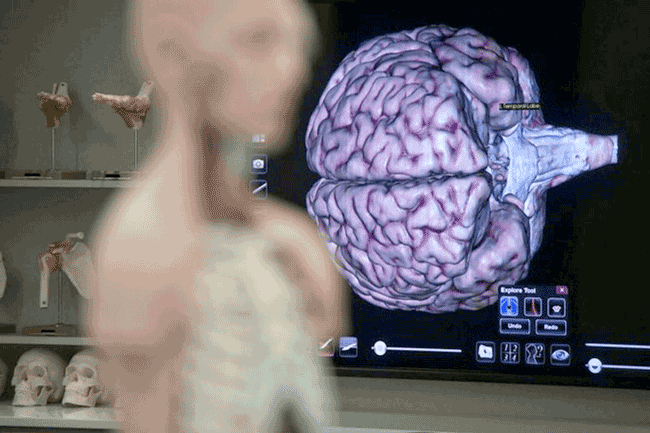 Singapore lập ngân hàng não