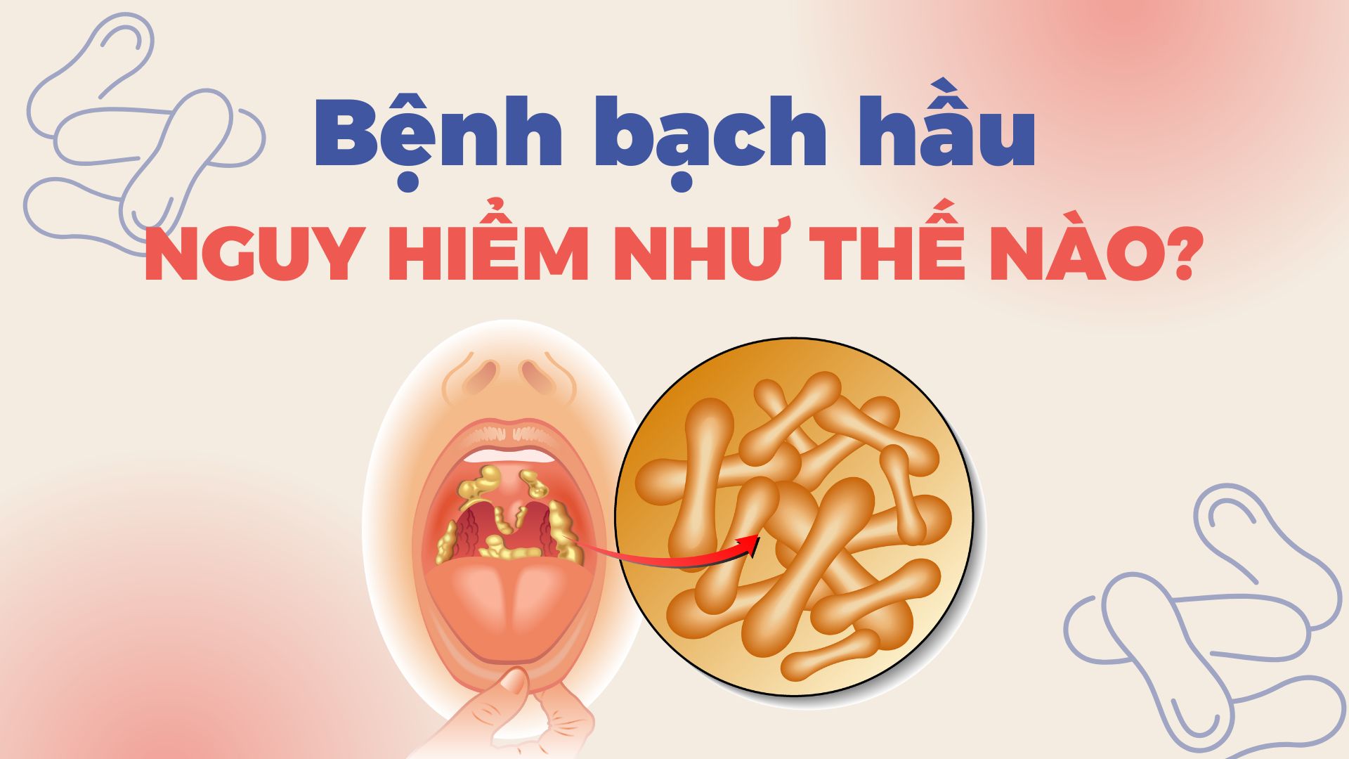 Bệnh bạch hầu nguy hiểm như thế nào?
