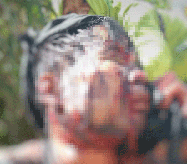 Đi thăm vườn sâm Ngọc Linh, một người bị gấu rừng tấn công nguy kịch