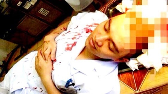 Dr. Le Quang Duong bleeds after the assault (Photo: SGGP)