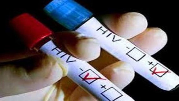 People living with HIV surge in many localities