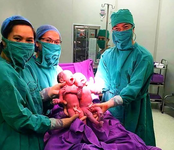 Medical workers with the twins  (photo: SGGP)