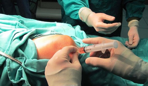 A joint replacement operation (Photo: SGGP)