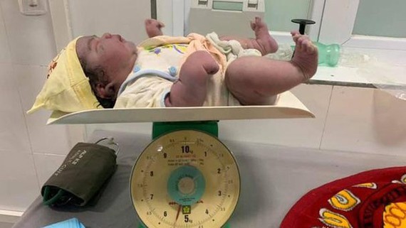 Mother naturally gives birth to one of largest babies ever born in Vietnam