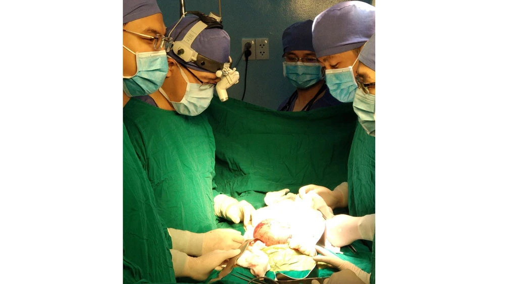 Các bác sĩ đang tiến hành phẫu thuật lấy mô thai cho một bé trai 