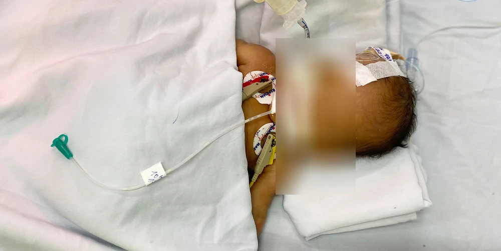 Bé trai đang được điều trị tích cự tại Bệnh viện quận Thủ Đức