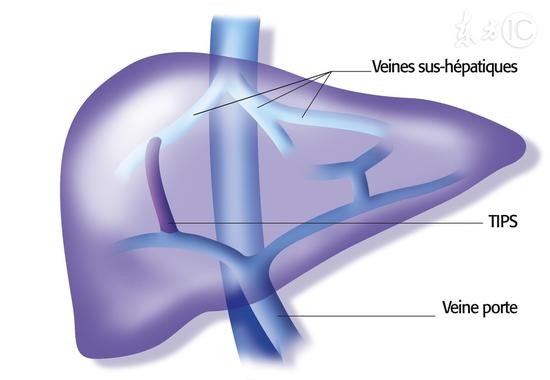 圖為人體肝臟。（示意圖源：互聯網）