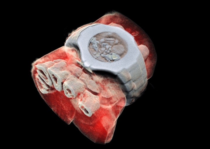 新西蘭奧塔哥大學研究人員菲爾·巴特勒（Phil Butler）和他的兒子安東尼·巴特勒(Anthony Butler)共同研製了一種新型掃描儀，對菲爾·巴特勒(Phil Butler)的手腕(包括手錶)進行了三維掃描。（圖源：MARS Bioimaging）