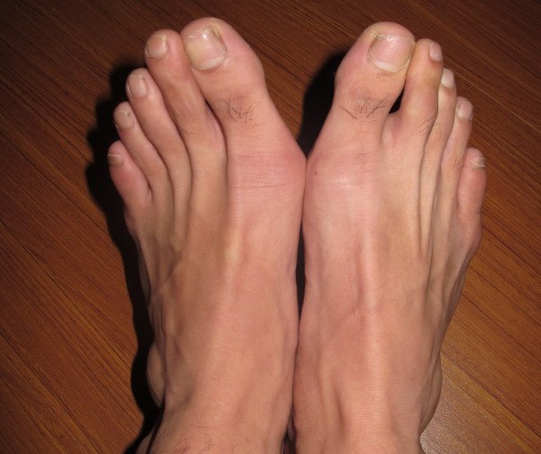 男人腎好壞看腳趾。（示意圖源：互聯網）