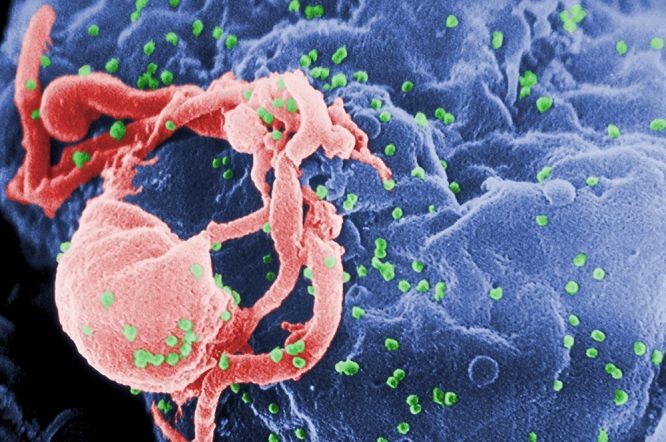英國倫敦一名愛滋病帶病毒者接受造血幹細胞手術後，很有可能同時令愛滋病康復。（圖源：路透社）