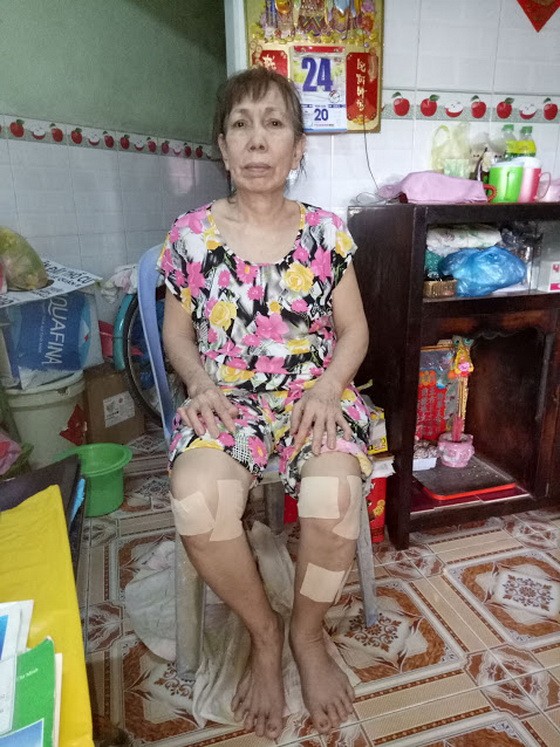 劉錦雲患有關節炎多年，如今左腿又骨折，正等待有錢動手術。