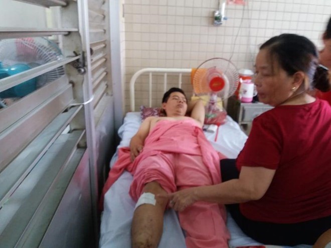 因工傷導致第8胸椎壓縮性骨折的病人阮德Th 卻被誤鑽腿部。（圖源：KĐ）