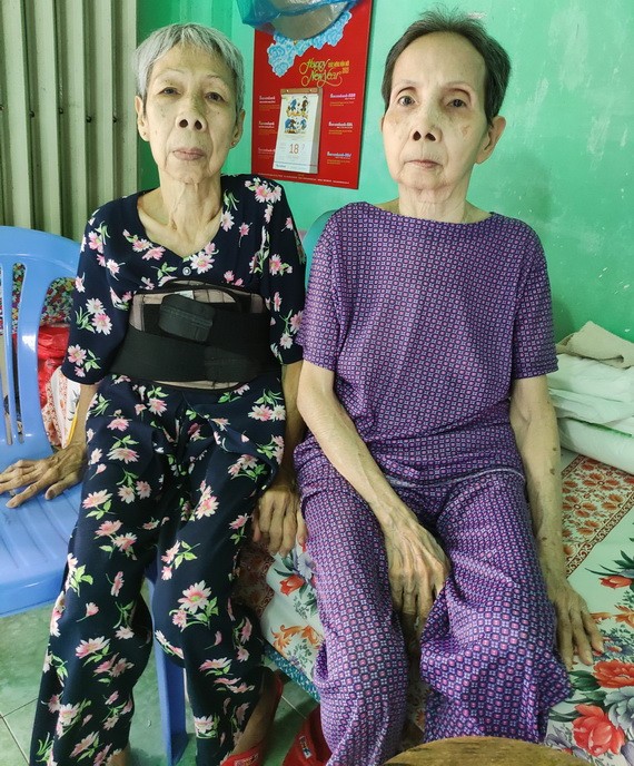 劉麗香（左）與姐姐劉麗芳均患上同樣的病症。