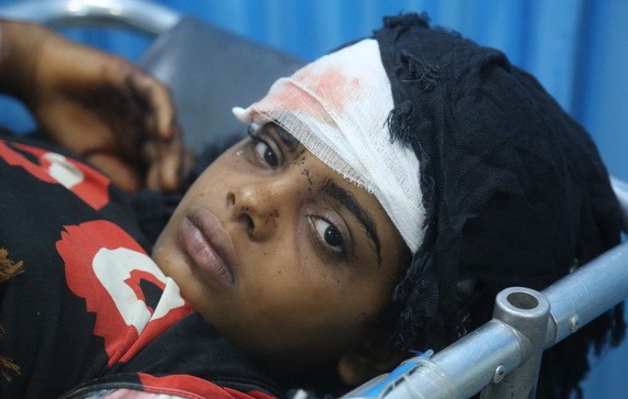 在也門荷台達的一所醫院，一名受傷的女孩正在接受治療。她和弟弟、叔叔一起受傷，當時一家人正試圖搬到遠離戰鬥的地區。（圖源：聯合國）