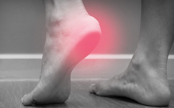 腳跟痛不一定是足底筋膜炎！