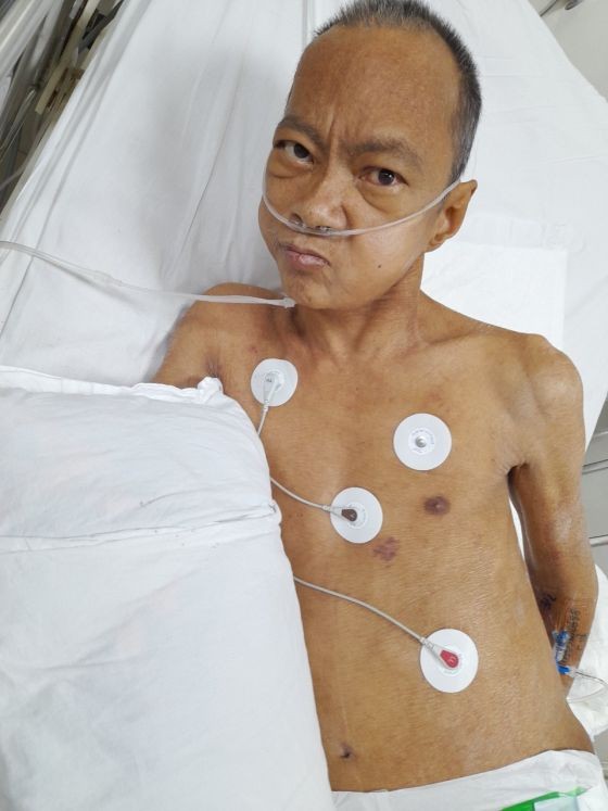洪玉山正在医院的重症急救室接受医治。