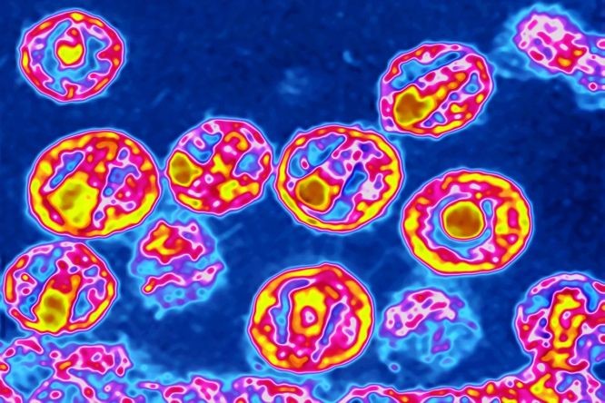 HIV病毒在彩色电子显微镜中的图像。（图：UIG）