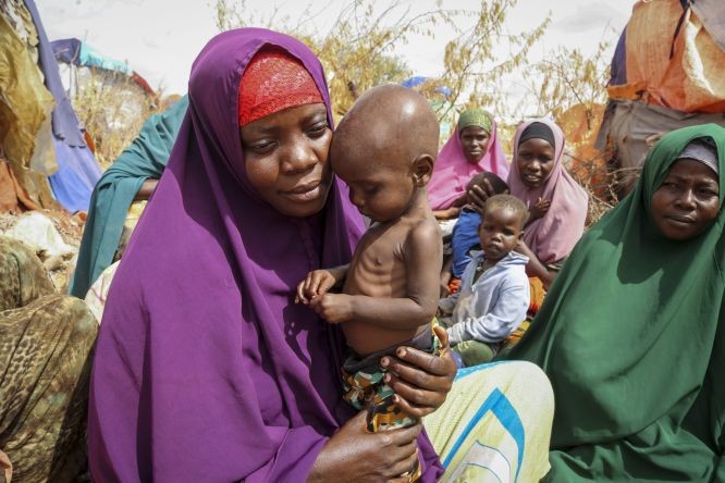 一名索马里妇女抱着营养不良的儿子。（图：AP）