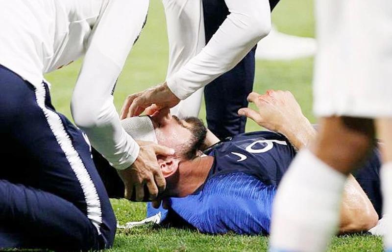 Giroud gặp chấn thương đầu. Ảnh: Getty Images 