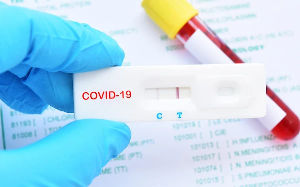 Xét nghiệm mới có thể phát hiện Covid-19 trước khi lây lan