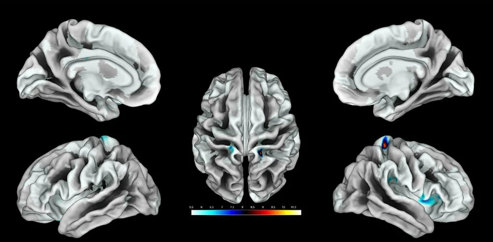 Vỏ não somatosensory phát triển tốt hơn ở những phụ nữ có tần suất quan hệ tình dục cao. Ảnh: AFP.