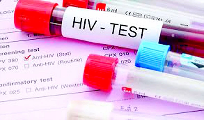 Tính mạng gần 2 triệu bệnh nhân HIV/AIDS bị đe dọa