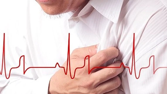 30% số ca tử vong ở Việt Nam do bệnh tim mạch