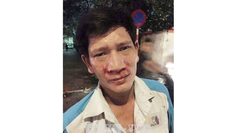 Anh Nguyễn Văn Sinh khuôn mặt bê bết máu do bị hành hung. Ảnh TTXVN