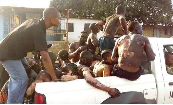 Các nạn nhân trong vụ va chạm xe bồn chở dầu được đưa tới một bệnh viện để điều trị ở tỉnh Kongo Central, Congo ngày 6-10-2018. Ảnh: Sputnik/TTXVN