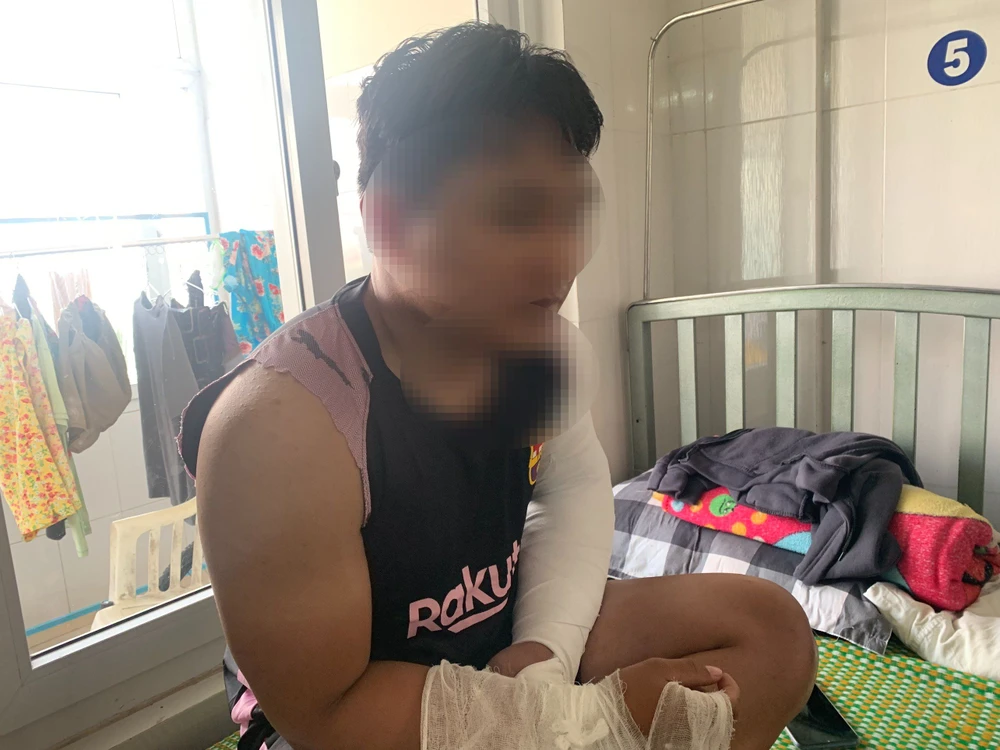 Anh L.A.Đ. (24 tuổi, trú huyện Nghĩa Hành, tỉnh Quảng Ngãi) bị đánh gãy 2 tay