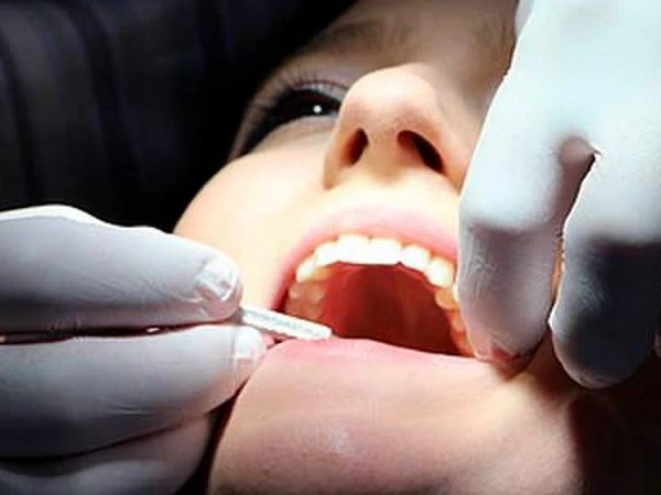 Thực phẩm chức năng ngăn ngừa bệnh răng miệng