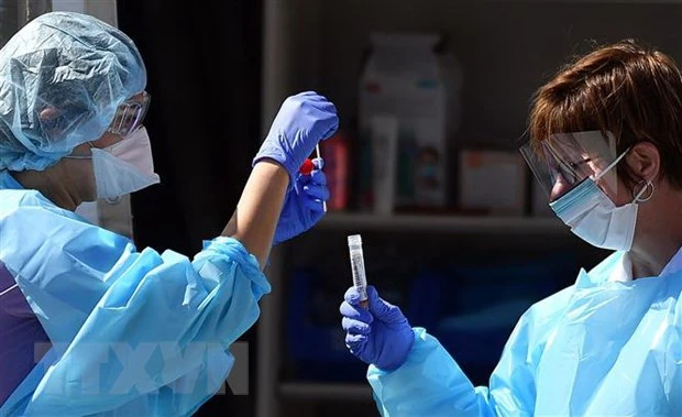 Nhân viên y tế kiểm tra mẫu bệnh phẩm của bệnh nhân nhiễm COVID-19 tại một cơ sở thí nghiệm ở San Francisco, bang California ngày 12/3/2020. (Nguồn: AFP/TTXVN)