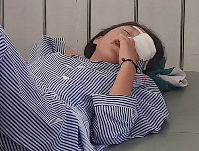 學生裴Ng.Q.A(14歲)，處於眼角膜破裂、內眼球嚴重受損等狀態下進院急救。