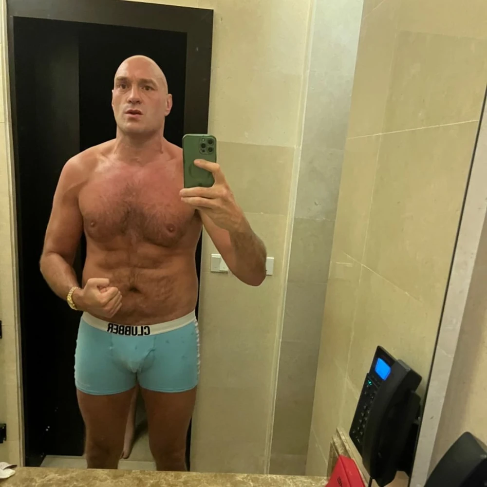 Hình ảnh trần tình của Fury trên Instagram: "Không thể không bị thương khi đấu tập"