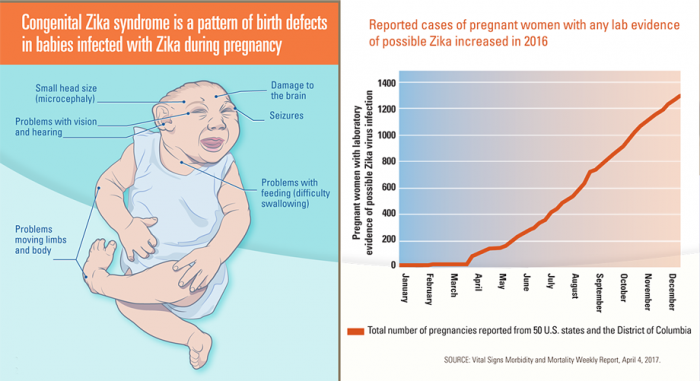 美約一成染寨卡孕婦面臨缺陷寶寶問題。（圖片來源：互聯網）