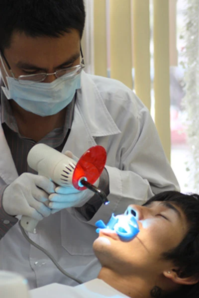 Vôi răng và những tác hại lớn tới sức khỏe răng miệng