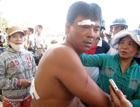 Đà Nẵng: Người của Trung Nam Group chém trọng thương người dân?