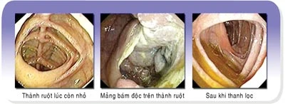 Thanh lọc cơ thể: Giúp đường ruột thông thoáng