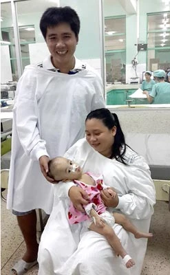 Ca tách song sinh tại Bệnh viện Nhi đồng 2: Bé Phi Long được cha mẹ vào chăm sóc