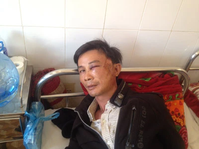 Đắk Lắk: Côn đồ ném đá xe tải gây nguy hiểm