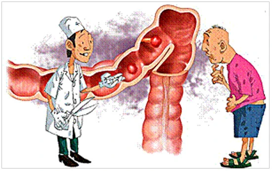 Viêm Đại Tràng điều trị ngay khi có dấu hiệu