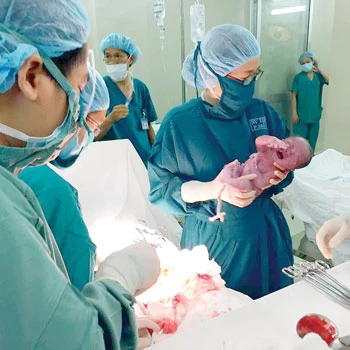Phẫu thuật tim thành công tại phòng mổ bệnh viện sản