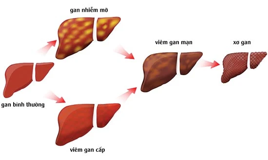 Rượu bia - uống như thế nào là đủ?