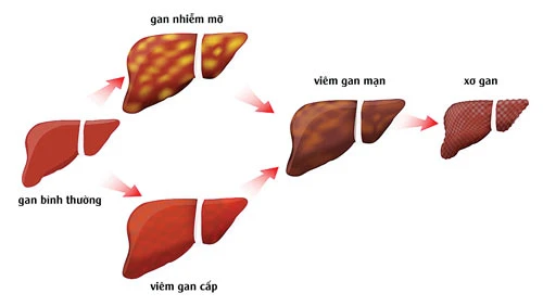 Rượu bia - uống như thế nào là đủ?