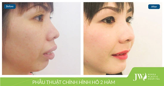 Hết hô chỉ sau 2 giờ