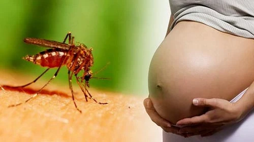 Chồng thai phụ nhiễm virus Zika ở Bình Dương có triệu chứng tương tự