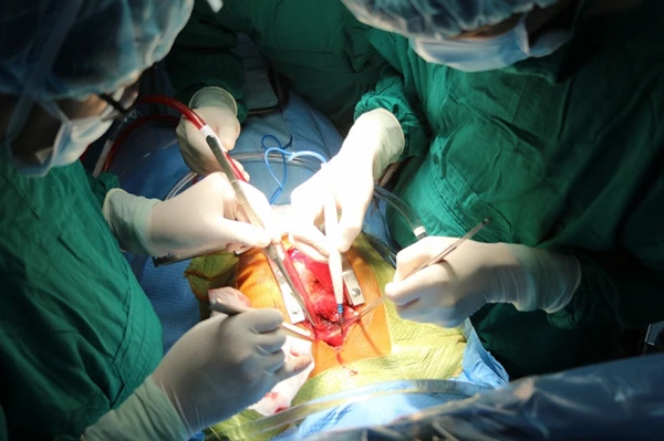 Phẫu thuật thành công cho bệnh nhi bị vỡ phình bóc tách động mạch chủ tuýp A