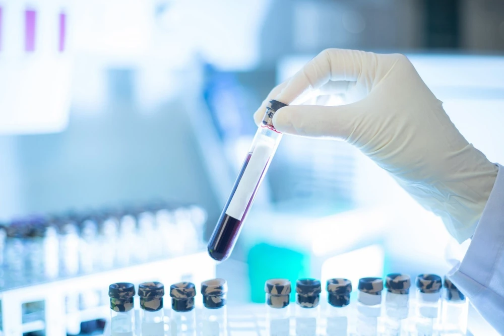 Xét nghiệm máu phát hiện sớm đa ung thư của Grail trên lộ trình xin được FDA cấp phép