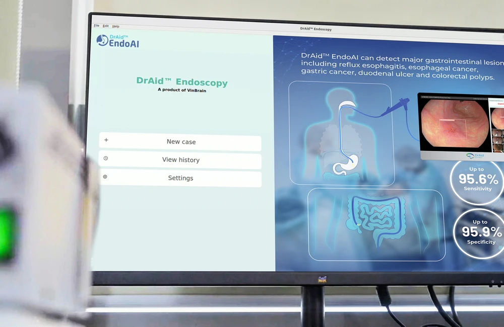 Gảii pháp DrAid EndoAI ứng dụng AI trong nội soi.