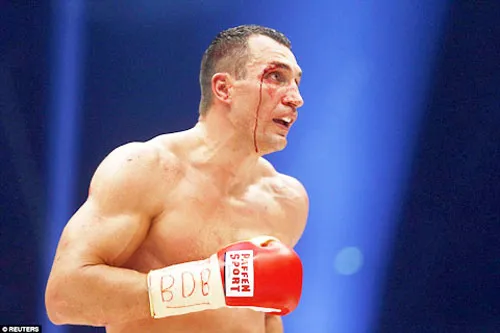 W.Klitschko chảy máu sau những pha tấn công của đối phương. W.Klitschko chảy máu sau những pha tấn công của đối phương.